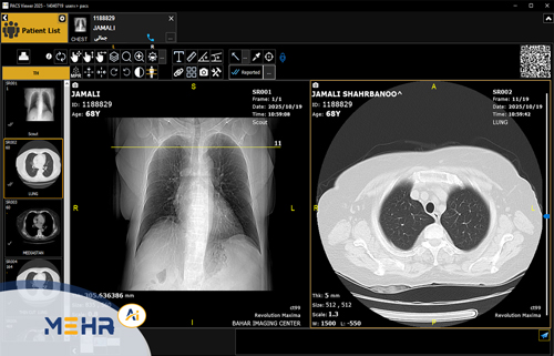 راهنمای جامع سامانههای PACS و نرمافزارهای تصویربرداری پزشکی مهر
