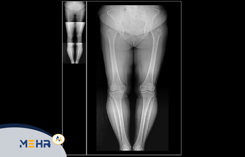 نرم افزار استیچ (Stitch )